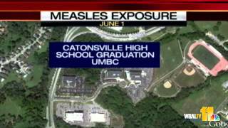 Marylanders Warned Of Possible Measles Exposure