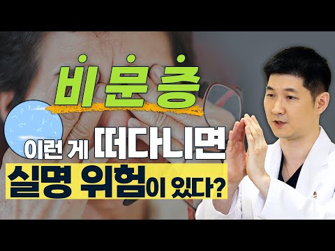 실명 위험! 비문증을 결코 가볍게 생각하면 안되는 이유 - 솔직한 안과 #4