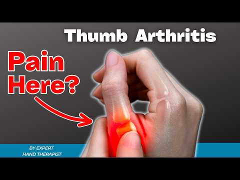 The BEST Management for Thumb Osteoarthritis!