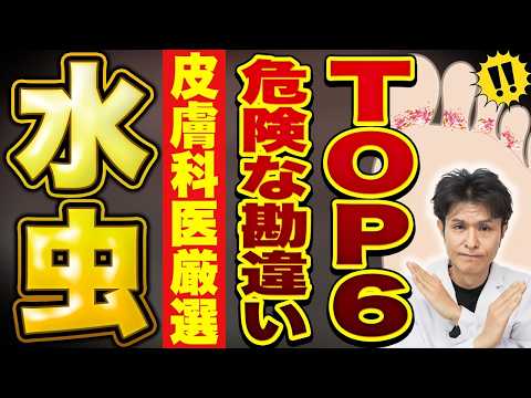 水虫これダメ絶対６選！注意したい水虫の治療や原因と対策法、薬についての解説