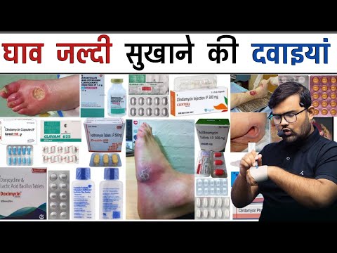 घाव सुखाने की दवाई | Wound Healing Medicine | Medicine | Treatment | Pharmacy | Doctor | Nursing