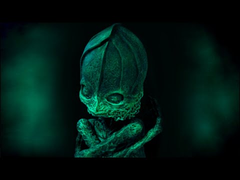 The Alyoshenka Incident - Russia's Alien Baby?