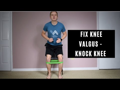 Fix Your Knee Valgus (Knock Knees)