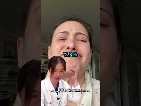 美容皮膚科医たかし先生がフケだらけの動画を見ながら解説！