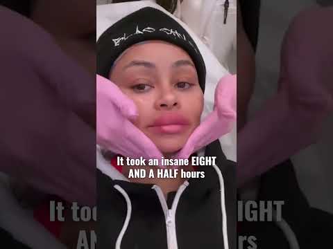 Blac Chyna's Unbelievable Transformation #shorts #blacchyna #plasticsurgeon #spillthetea