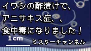 作ったイワシの酢漬けでアニサキスに当たりました！必ず冷凍しましょう！無職、アウディレジェンドの楽しい日常、