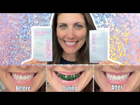 WOW! INOPRO Teeth Whitening Strips Results After Just 1 Use & Tutorial