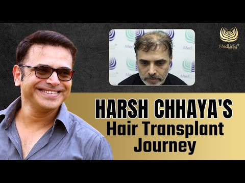 Harsh Chhaya's Hair Transplant Journey | Celebrity Hair Transplant | Medlinks