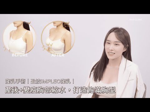 隆乳手術｜盈波IMPLEO隆乳｜產後+變瘦胸部縮水，打造飽滿胸型