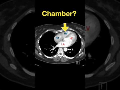 Heart Anatomy #shorts - Part E