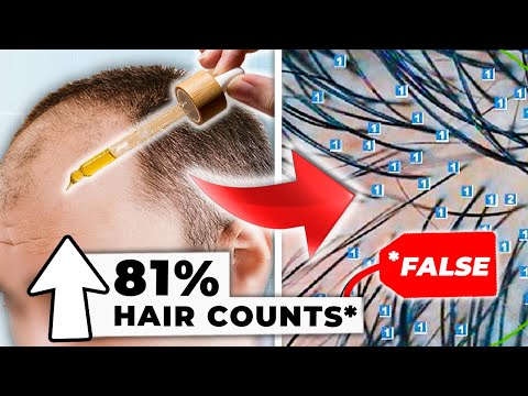 Deceptive But Legal: 3 Ways Marketers Cheat Hair Loss Studies