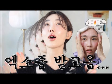 Eng)4세대 스킨부스터? 엑소좀 받고 옴..🔥미치게 아픈데 효과는요 (내돈내받)