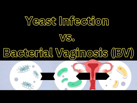 Yeast Infections vs Bacterial Vaginosis (BV) | Nursing Cheat Sheet | @nurseinfocanestar