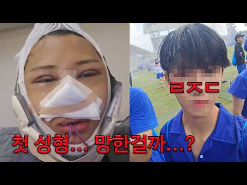 다 갈아엎었습니다. 수술직후 ??에서 존잘남 탄생 (20대 성형,윤곽,눈,코) [의진Vlog]