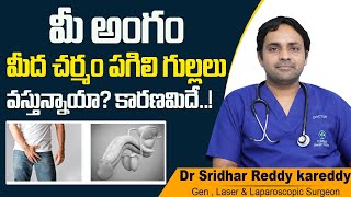 Early Signs of Diabetes in Men || Foreskin Infection Due to Diabetes || Treatment Range Hospital