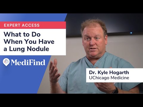 Lung Nodules: When to Worry + What to Do Next, Explained by Bronchoscopy Expert Dr. Kyle Hogarth