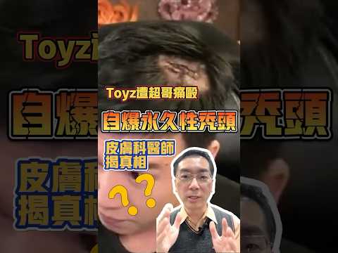 Toyz遭超哥痛毆，自爆永久性禿頭，皮膚科醫師揭真相！#shorts