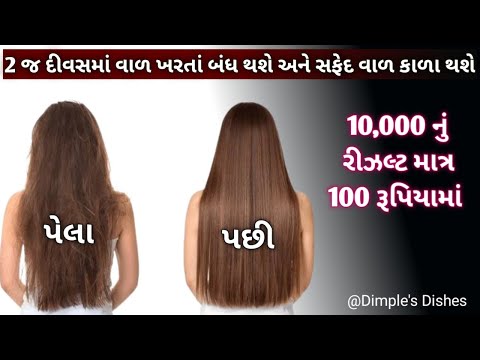 વાળ ની બધી જ સમસ્યાનુ 1 મા જ સમાધાન -Hair fall solution-fast hair regrowth - DIY Onion Oil-amla oil|