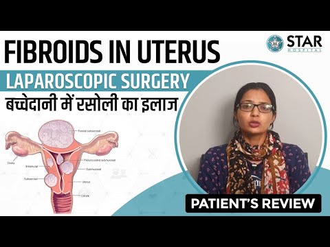 Fibroid Uterus Treatment in Panchkula | Fibroid Uterus Surgery in Panchkula | Fibroid Uterus Doctor