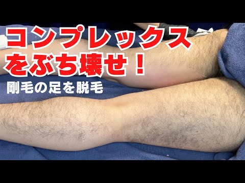 【ワックス脱毛】剛毛を一瞬でツルツルにする脱毛【京都脱毛】【施術動画】