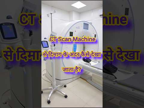 CT Scan Machine से दिमाग के अंदर कैसे देखते है? #anatomy