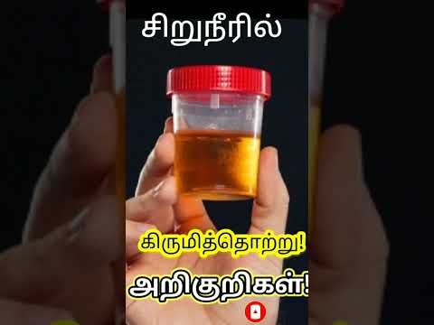 Urine infection in Tamil/Urinary Tract Infection Tamil/Urine Culture test/Urine infection Symptoms