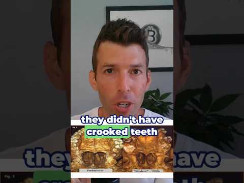 How diet causes crooked teeth