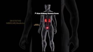 How kidney stones form ? #shorts #kidneystone #renalstone #kidneystoneproblems #health #ytshorts