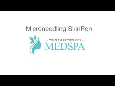 Microneedling Service Timeless at Tiffany's Medspa in Gilbert, AZ