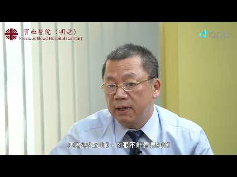 【脫痣一次脫清 否則容易再生】寶血醫院全科醫生何兆輝