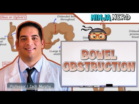 Bowel Obstruction | Clinical Medicine