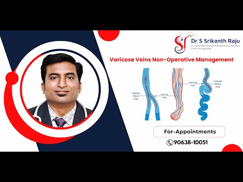 Varicose Veins Non-Operative Management | Dr.S.Srikanth Raju | Vascular Surgeon | Hyderabad