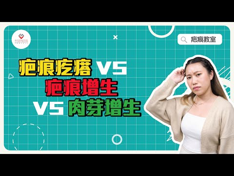 【疤痕教室】EP5 疤痕疙瘩 vs 疤痕增生 vs 肉芽增生｜一片說清三者分別