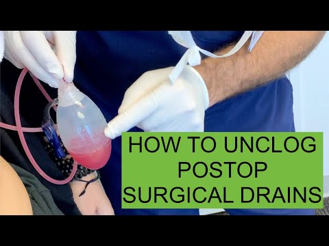 DRAIN CARE 101: How to UNCLOG your postoperative surgical drain