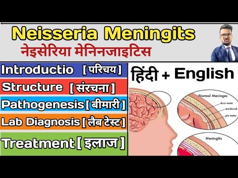 Neisseria Meningitidis Microbiology | Neisseria Meningitidis in hinid | What is Meningitidis