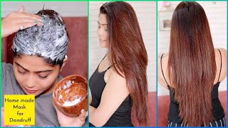 MY CURRENT HAIR CARE ROUTINE | Dandruff Treatment at Home #dandruff #haircare #winterhaircare