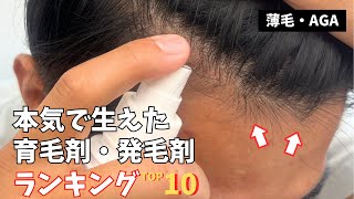 【2023年】一番髪の毛が生えたオススメの育毛剤・発毛剤ランキングTOP10