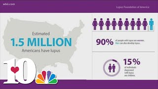 Lupus Awareness Month starts today