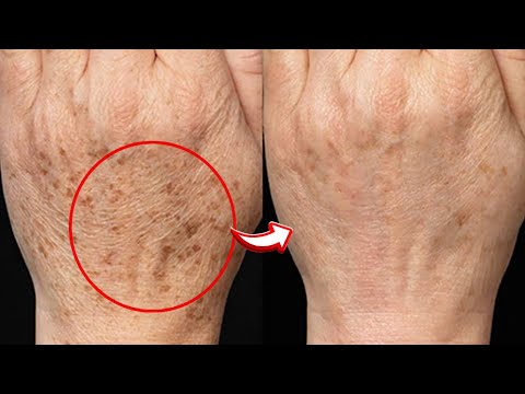 Get Baby Soft Wrinkle Free Hand At Home | Keep Your Hands Sof and Glowing