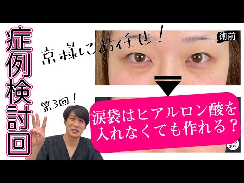 【症例検討回その③】ヒアルロン酸を使わなくても涙袋ができる！？【美の主治医京様】