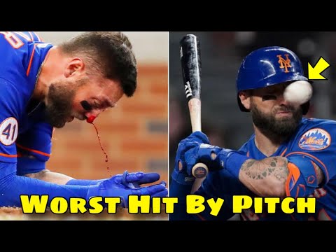 MLB Painful Hit By Pitch