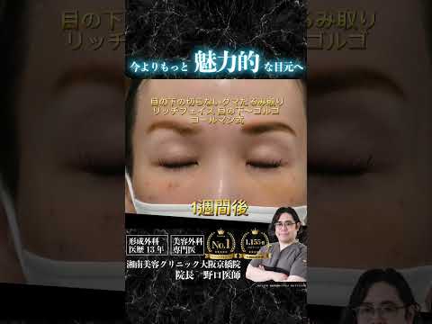 野口院長による若返り手術👨‍⚕️#湘南美容クリニック京橋院 #湘南美容クリニック #美容外科専門医#若返り美容