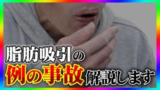 【緊急解説】顔の脂肪吸引事故の真相と今後の対策について