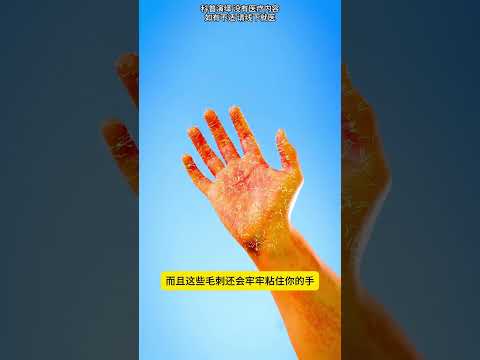 世界上最痛的树叶，有人受不了自杀了 #科普 #科普知识 #涨知识