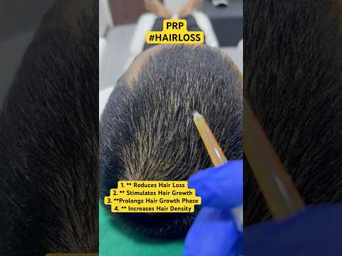 Best Hair Loss Treatments | Hair PRP | #shorts #hair #haircare #prp