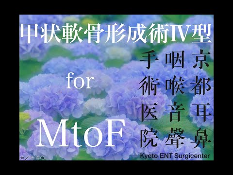 MtoF の方への甲状軟骨形成術Ⅳ型