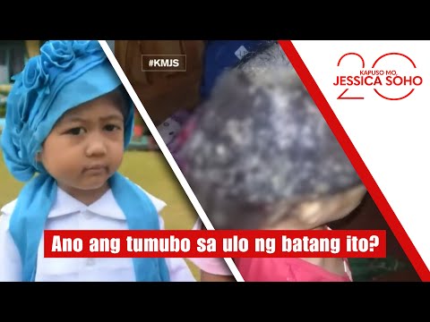 Ano ang tumubo sa ulo ng batang ito? | Kapuso Mo, Jessica Soho