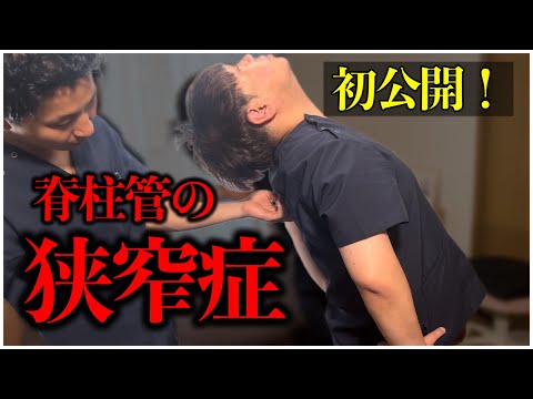 【治療家用】初公開！脊柱管狭窄症に対する手技とは？