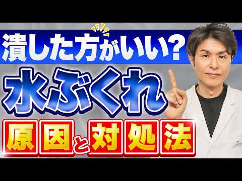 その水ぶくれ潰す？潰さない？水ぶくれの原因８つと対処法【かぶれ、とびひ、汗疱、帯状疱疹、やけど】皮膚科医が解説