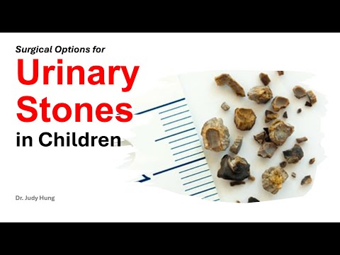 Surgical Options for Urinary Stones in Children by Dr Judy Hung (October 5, 2021)